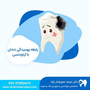 رابطه پوسیدگی دندان با ارتودنسی دکتر نجمه تحویلدارنژاد