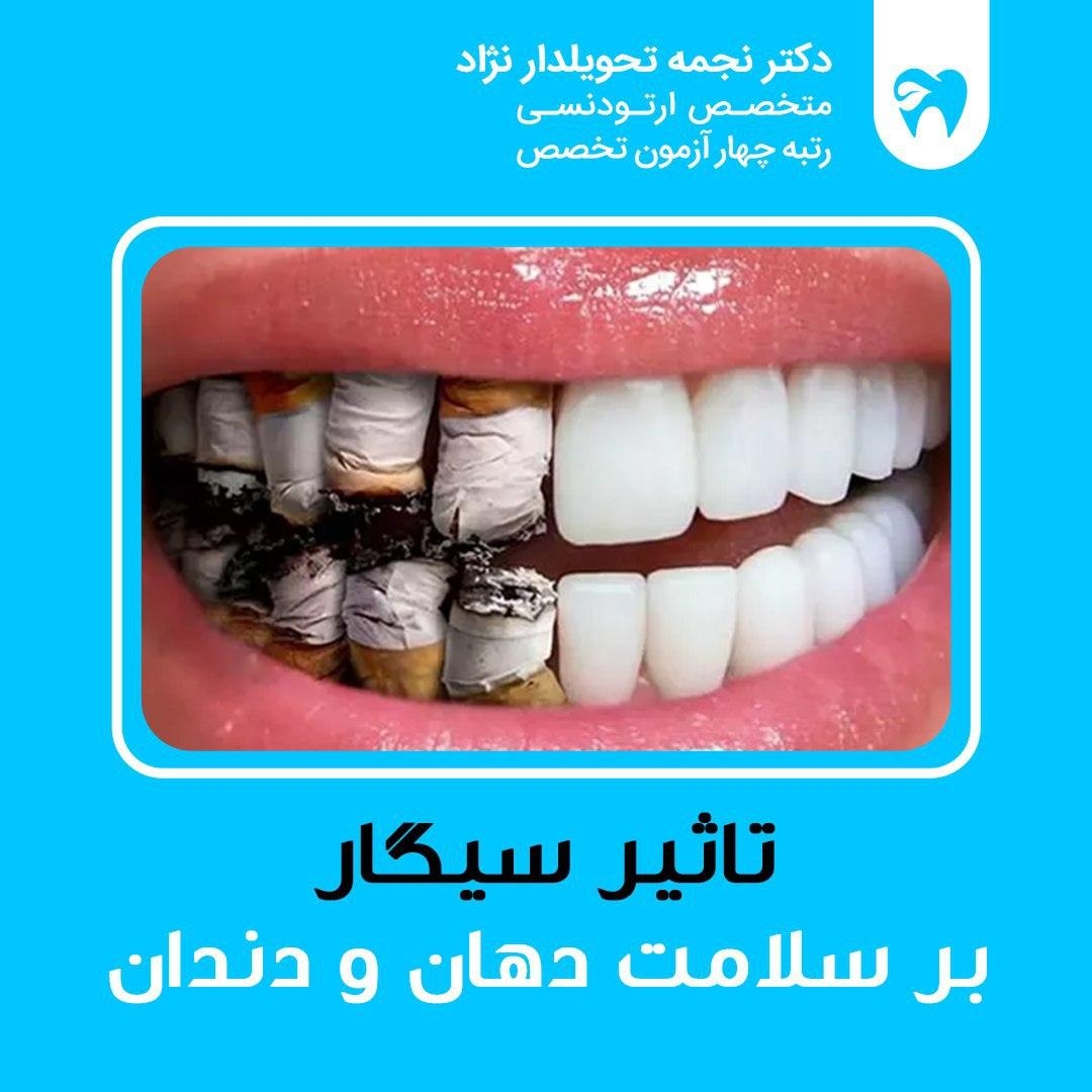تاثیر سیگار بر سلامت دهان و دندان