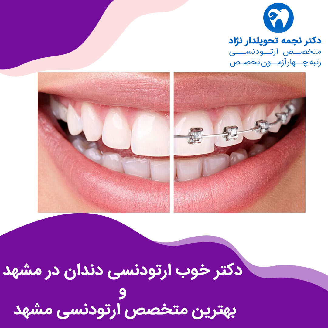 دکتر خوب ارتودنسی دندان در مشهد و بهترین متخصص ارتودنسی مشهد