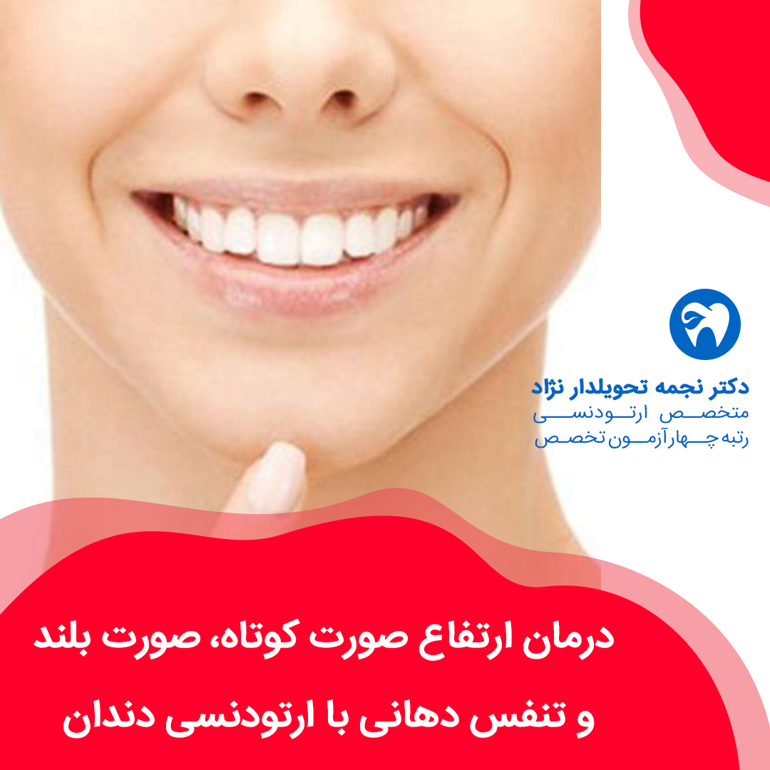 درمان ارتفاع صورت کوتاه و صورت بلند و تنفس دهانی با ارتودنسی دندان 