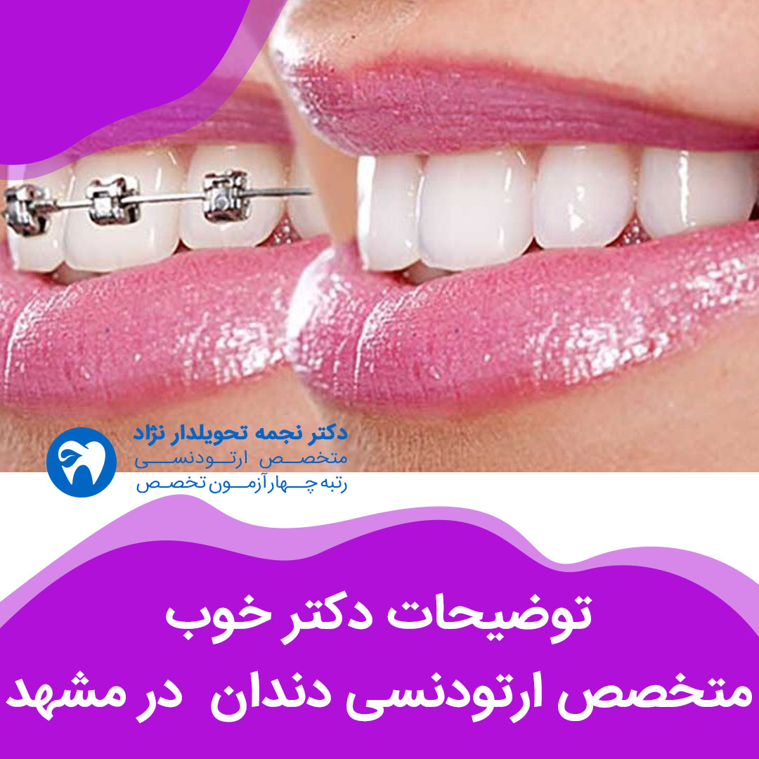 توضیحات دکتر خوب متخصص ارتودنسی دندان در مشهد