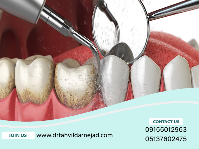 علل جرم گیری کردن دندان قبل از ارتودنسی