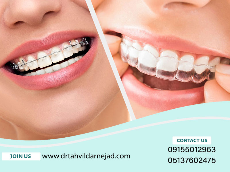 ارتودنسی متحرک بهتر است یا ثابت؟