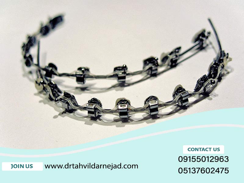 سیم‌های آلومینیومی ارتودنسی