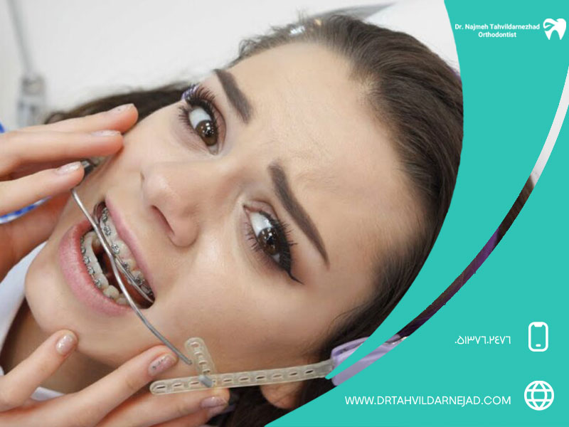 معایب و چالش ‌های استفاده از هدگیر ارتودنسی