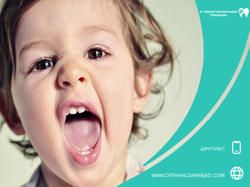 دلایل سیاهی لثه در کودک + راهکارهای رفع آن