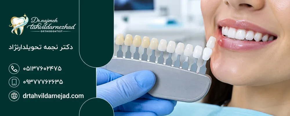 روش‌های سفید کردن کامپوزیت؛ آیا می‌شود رنگ کامپوزیت را تغییر داد؟