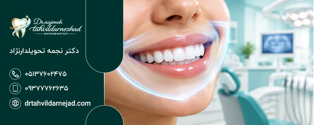 چگونه از تغییر رنگ کامپوزیت جلوگیری کنم؟